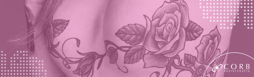 Tatuagem pós-câncer: mulheres decoram seios depois da mastectomia.
