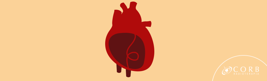 Confira quais são os sintomas precoces do infarto