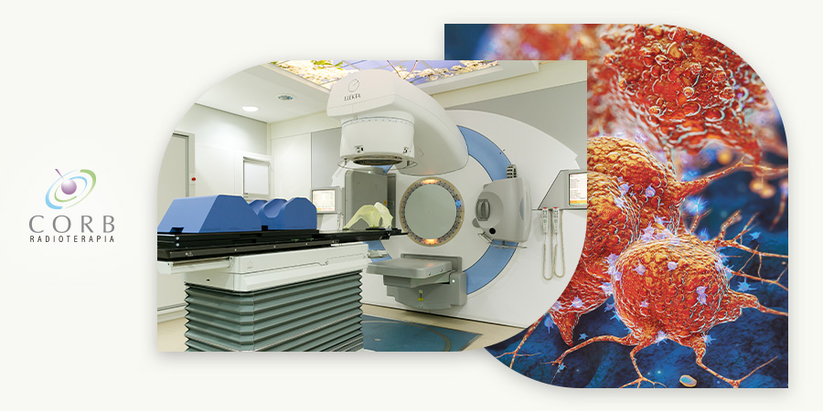 Radioterapia no tratamento de carcinoma