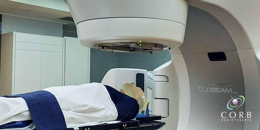 Radioterapia de cabeça e pescoço: quando é indicada e como funciona?
